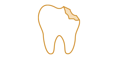 Chipped teeth