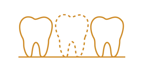 Missing teeth