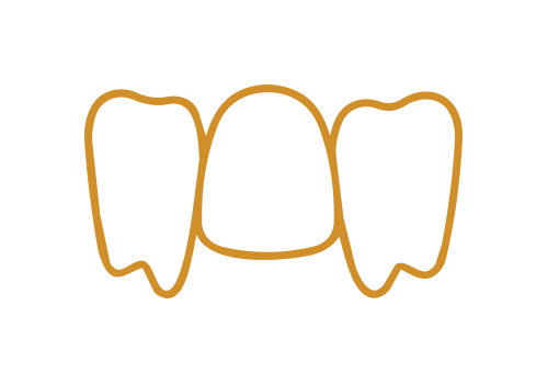 Osborne Cosmetic dental - Clear Aligners-06