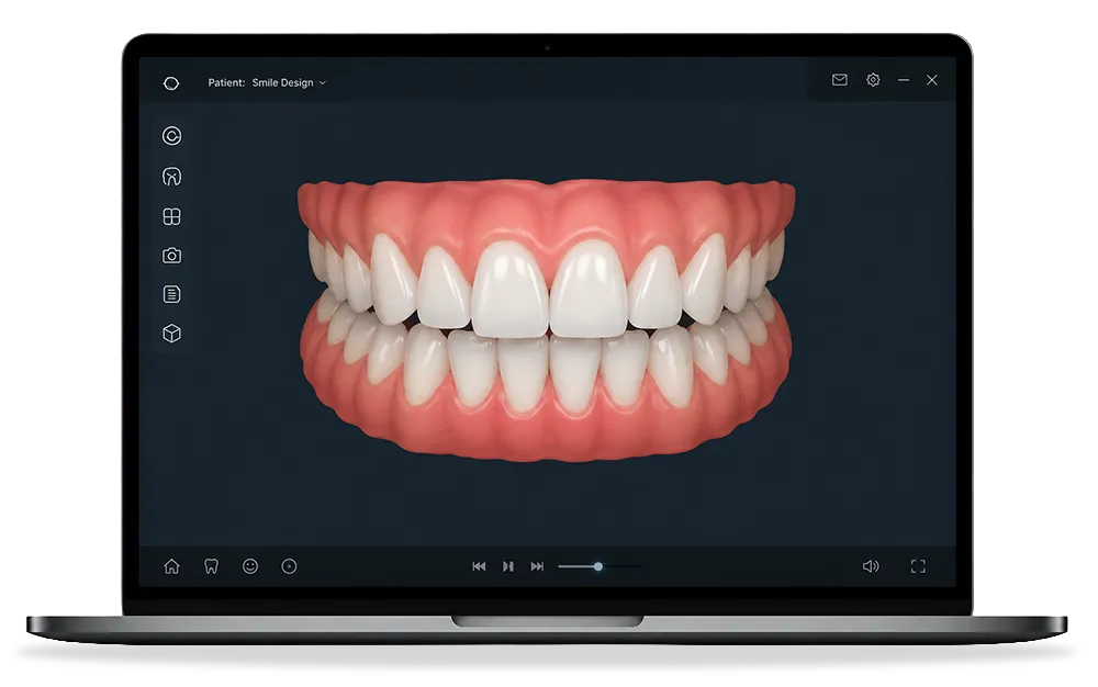 Digital smile design Digital smile design
