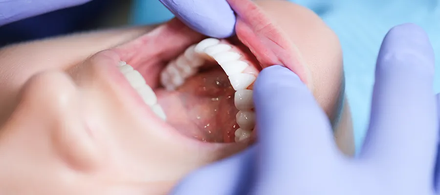 Osborne Cosmetic dental - Smile Design-013
