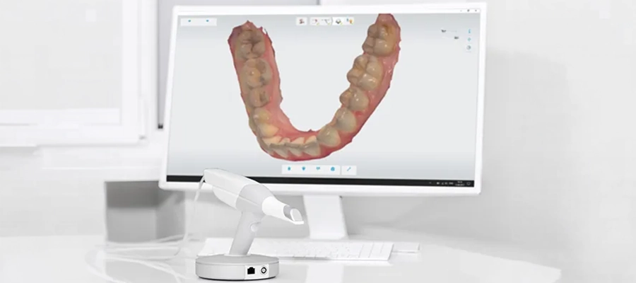 opcd-CAD-CAM restorative technology
