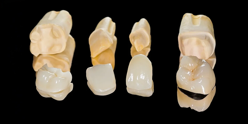 opcd - Cosmetic Dentistry - Ceramic Crowns